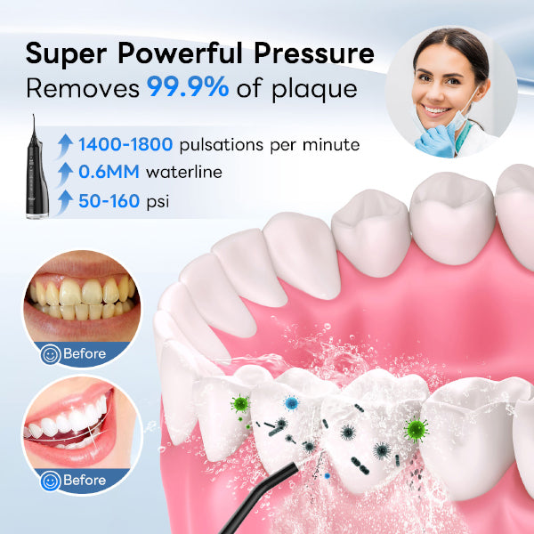 Water Dental Flosser: Enjoy a Deep Clean and Fresh Breath - Makeupforest